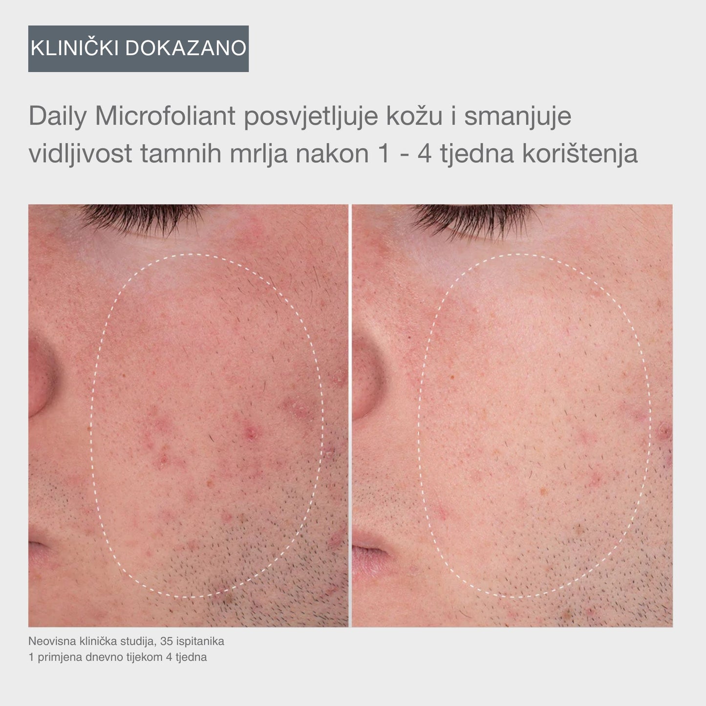 the first snow of the season